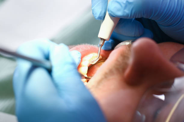 Best Emergency Denture Repair in Junction, TX