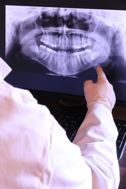 Best Emergency Wisdom Teeth Removal in Junction, TX