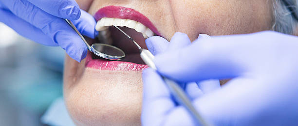 Best Emergency Dental Care for Broken or Chipped Teeth in Junction, TX